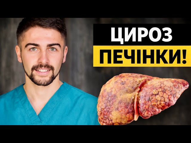 Хто вилікувався від цирозу печінки