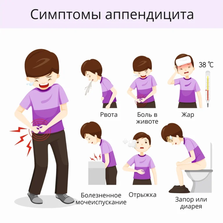z-iakoho-boku-apendytsyt-roztashuvannia-bil-i-symptomy-93cf